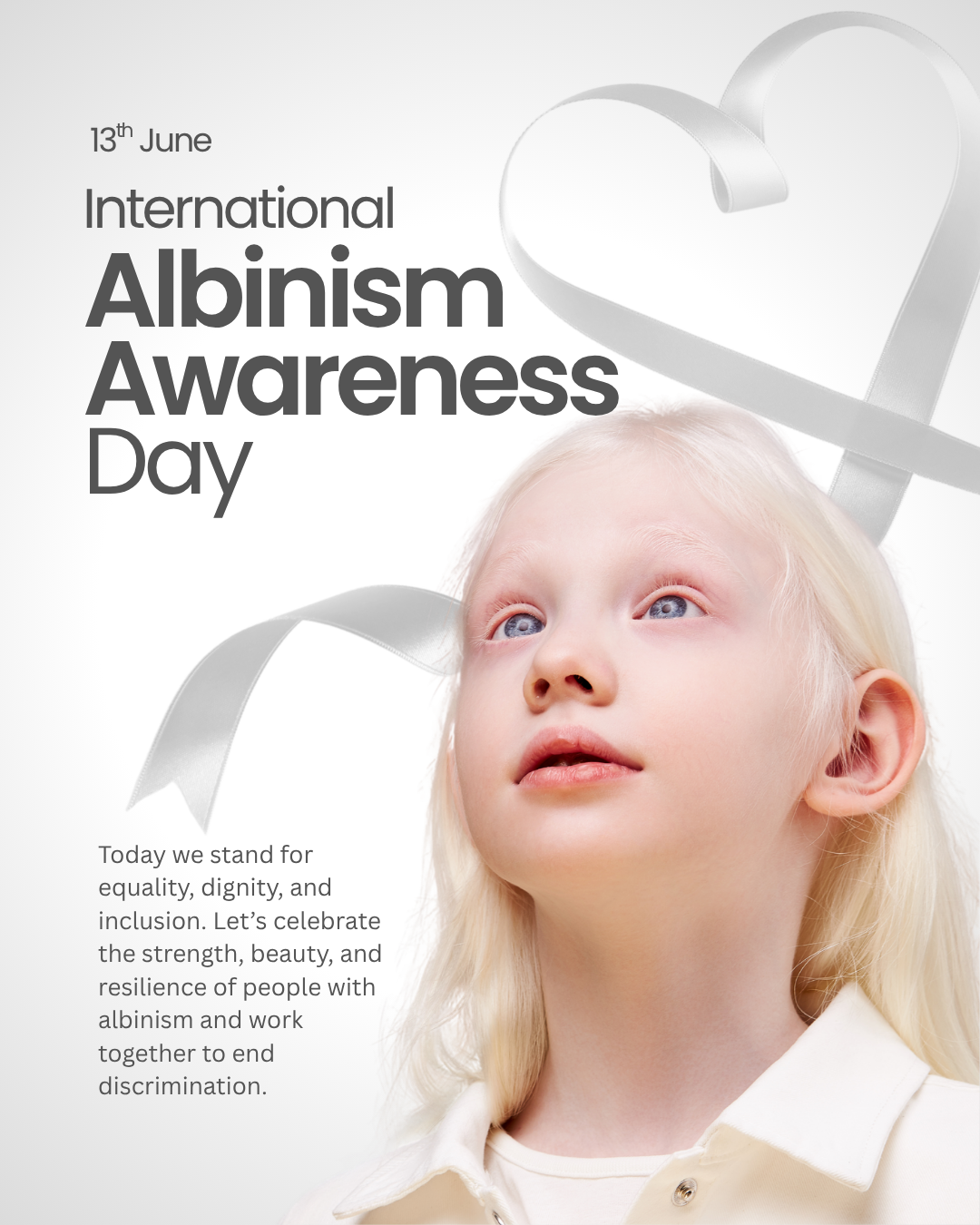 Albinism